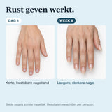 Startset