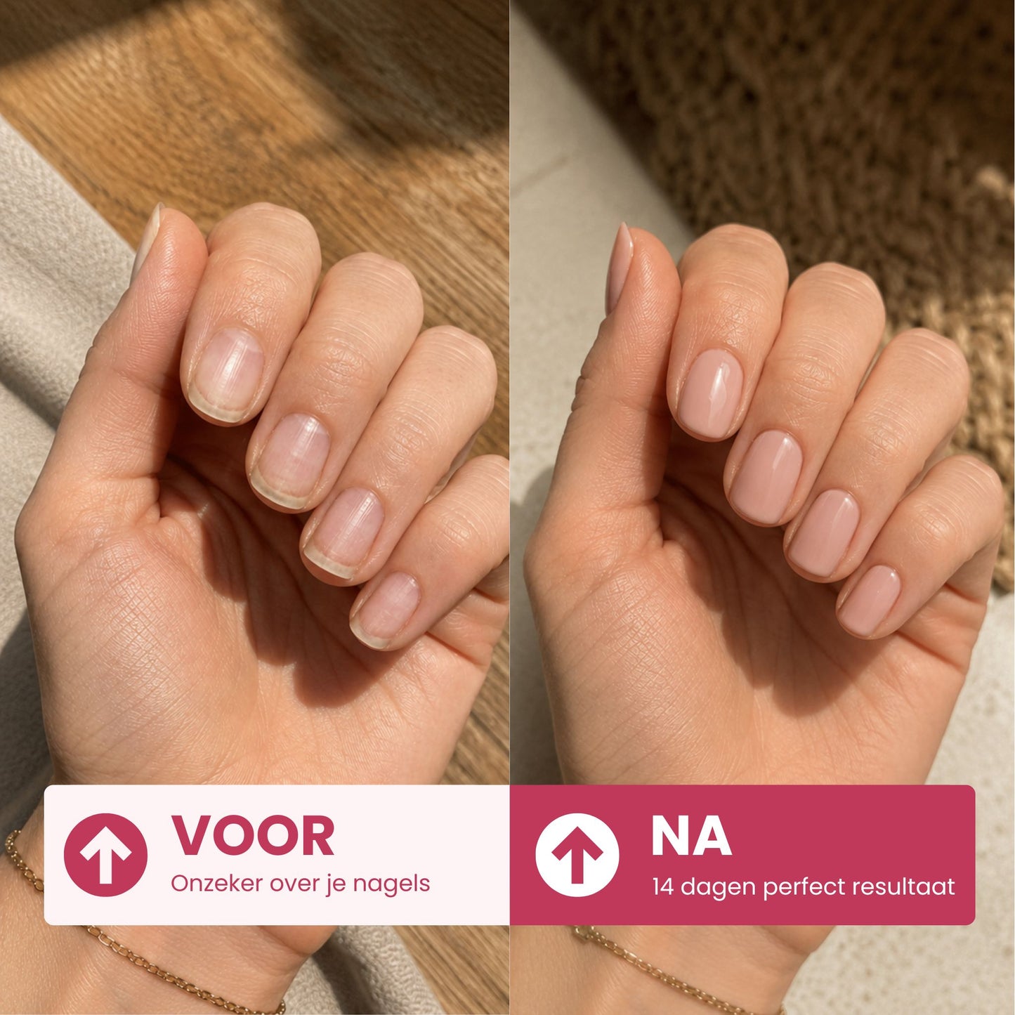 Gelstickers Starterset