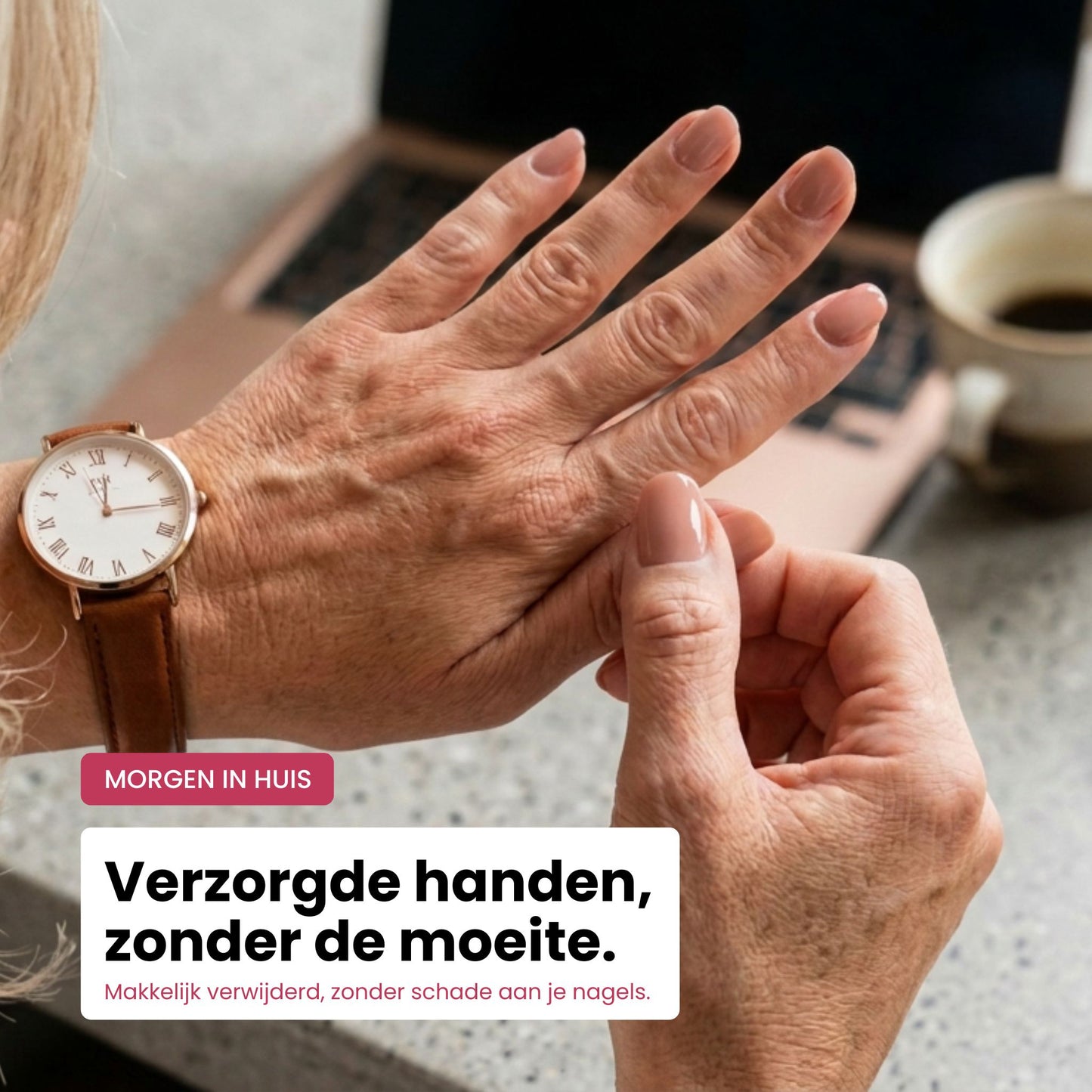 Gelstickers Starterset