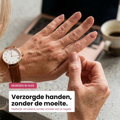 Gelstickers Starterset