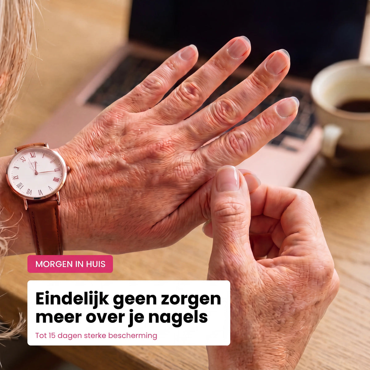 Gelstickers nagelbescherming