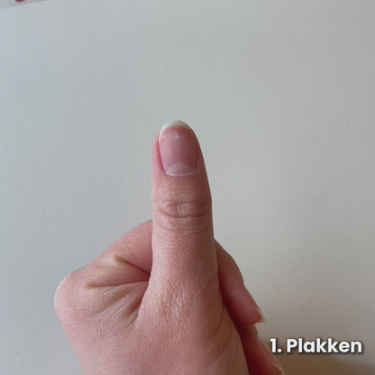 Gelstickers Starterset